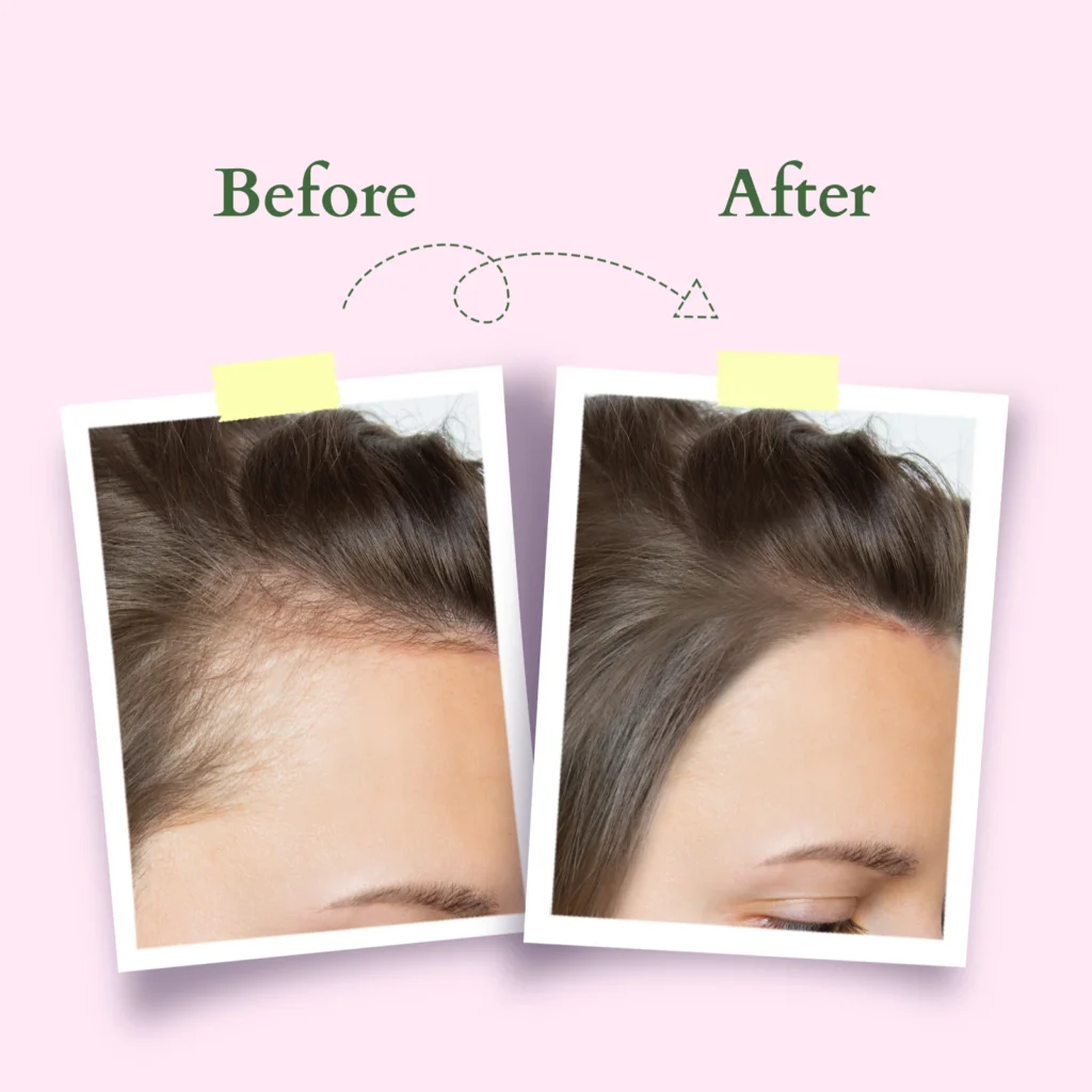 Growth Activator Hair Spray